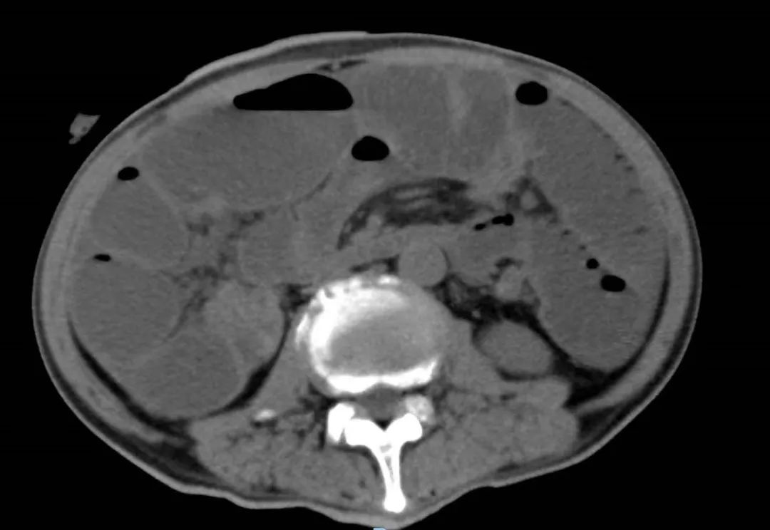 积水潭医院新龙泽院区急诊,北京积水潭医院骨科新龙泽院区