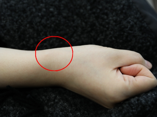 万万没想到，抱孩子姿势不对竟然抱出了腱鞘炎