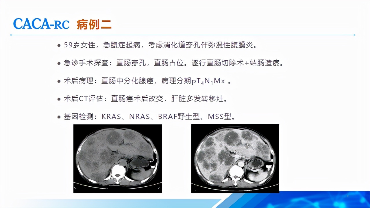 顾艳宏教授,顾艳宏医生全国排名