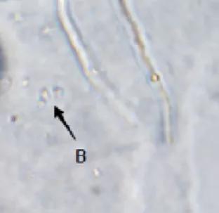 水产养殖霉菌怎么处理,水产养殖杀水霉方法