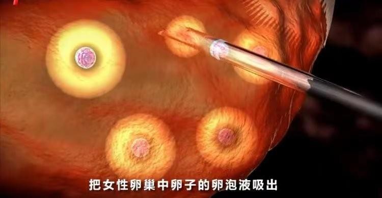 *市黑**卖卵，非法代孕，不打麻药穿刺下身：女大学生要小心卖卵*局骗**