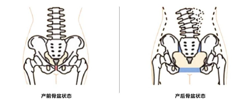 产后10个月漏尿怎么恢复,产后腰疼漏尿什么原因