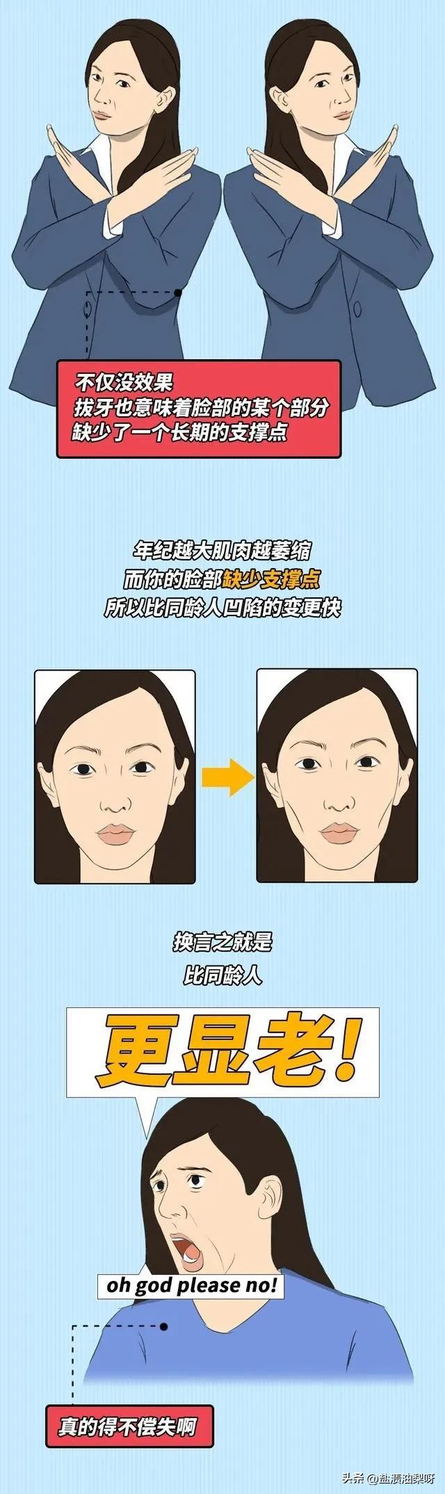 国字脸拔智齿会瘦脸吗,拔智齿能瘦脸的真实原因