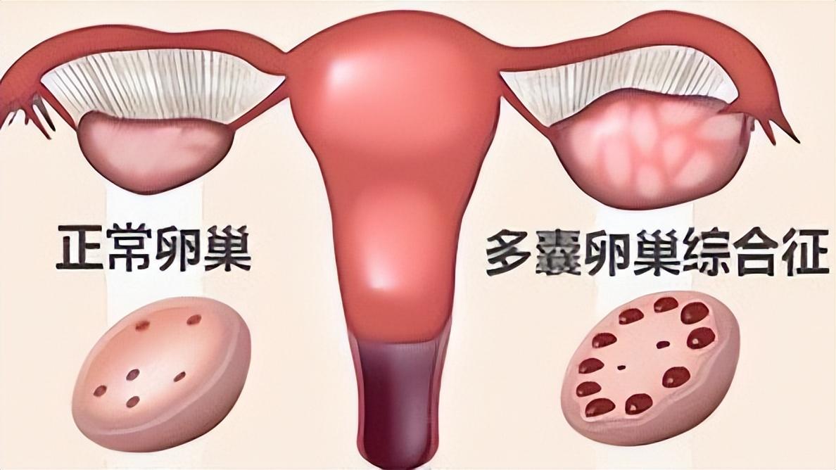 不知道月经准确时间怎么算排卵期,月经过后第几天排卵期