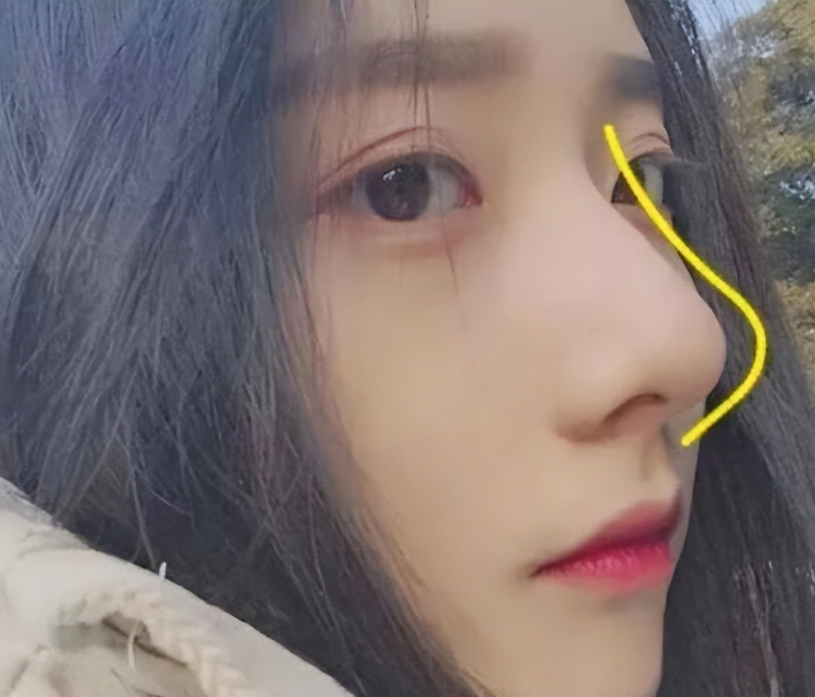 如何拥有翘鼻头,怎样可以拥有小翘鼻子