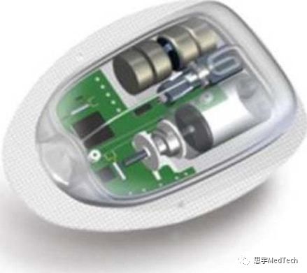 五代无管路自动胰岛素泵,进口最先进的胰岛素泵