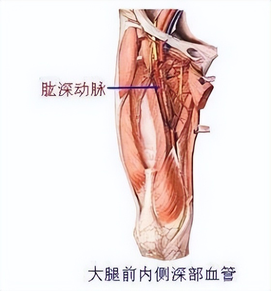 预防深静脉血栓的护理措施有哪些,下肢静脉血栓护理查房ppt汇报