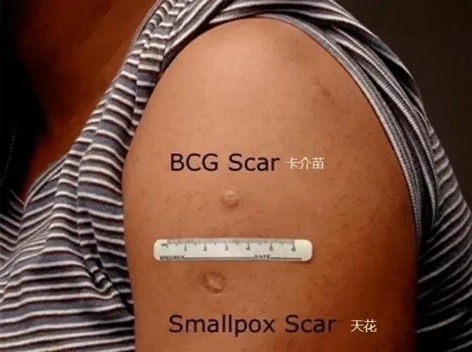 爆笑！得了甲流错吃*肥药减**，网友:吃了这药放的每个屁都不能信任