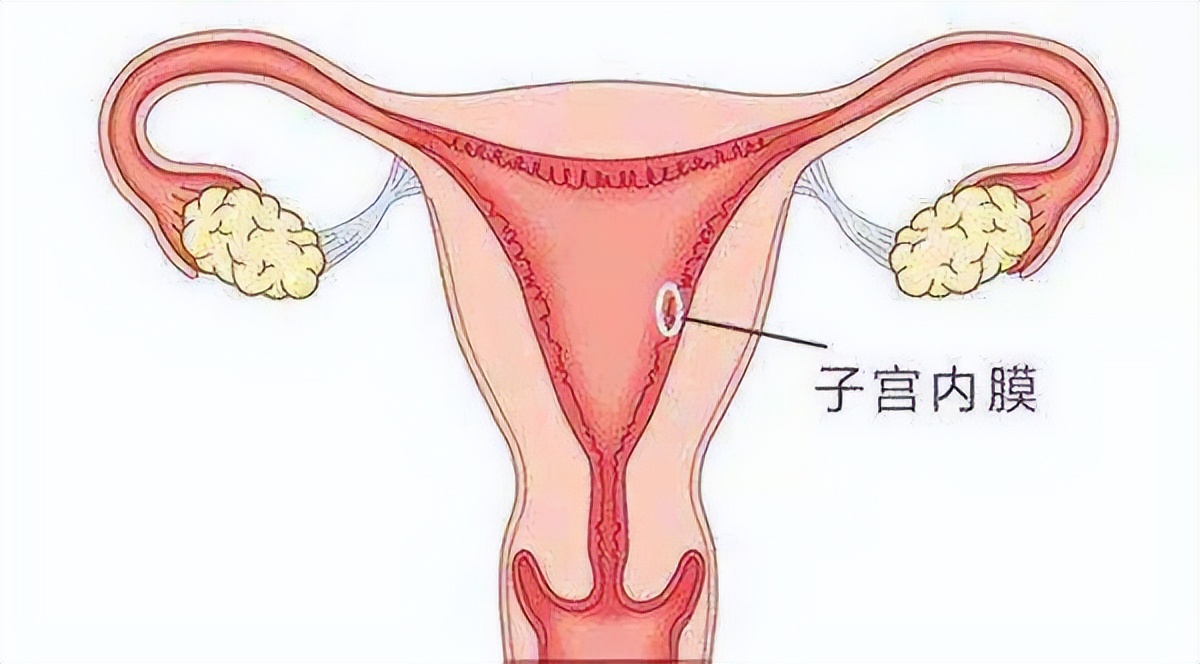 人流后子宫内膜回声不均匀啥意思,子宫内膜厚度12mm回声不均匀