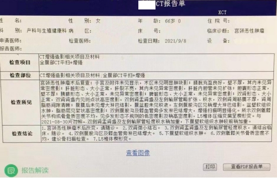 66岁患者宫颈癌复发，通过治疗恢复良好