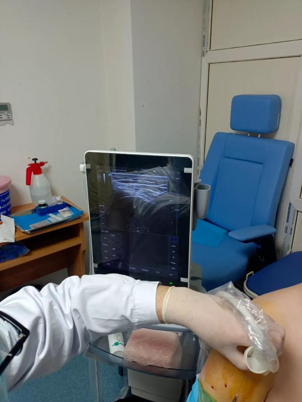 网球肘prp治疗后疼痛,网球肘prp治疗效果怎样