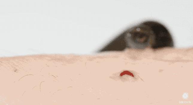 夏日带孩子户外活动当心这种虫,暑期带娃小心毒虫