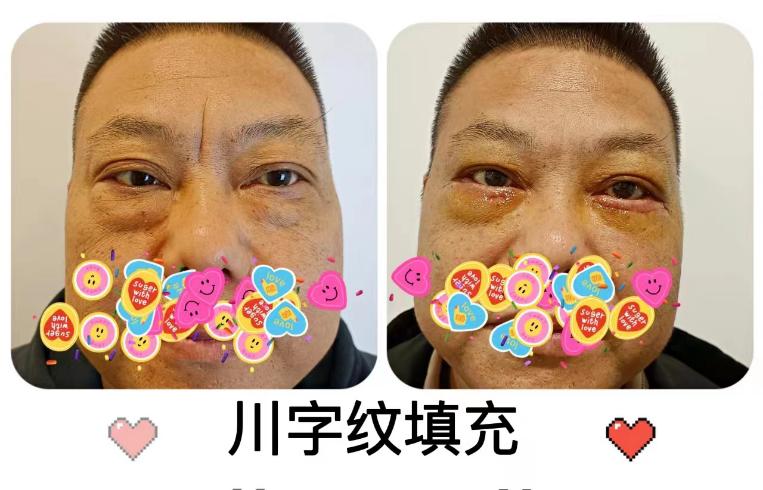 医疗美容变美秘诀,美容科医生教你悄悄变美