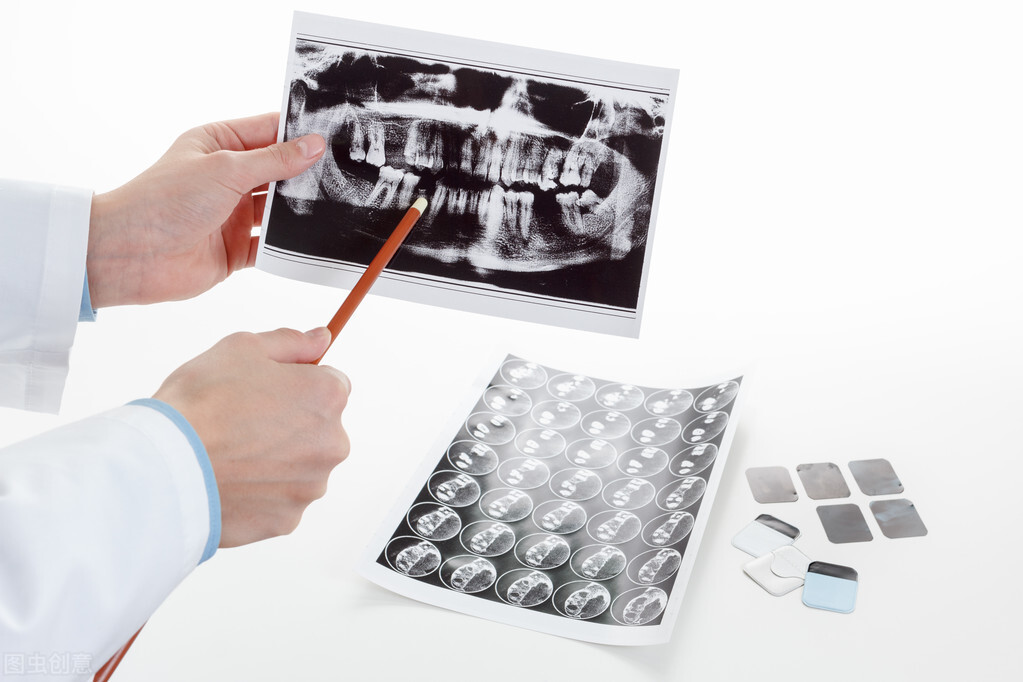 看牙频繁拍片真的没影响吗,牙拍片一年拍5次对人有什么危害