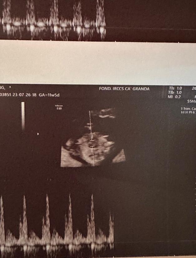 千里寻椰未婚先孕是真的吗,千里寻椰肚子里的孩子是谁的