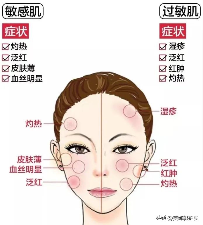 敏感肌泛红用什么护肤抗皱,如何正确认识敏感肌