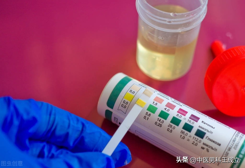 尿事虽小，意义重大！一分钟教你查看尿常规报告单