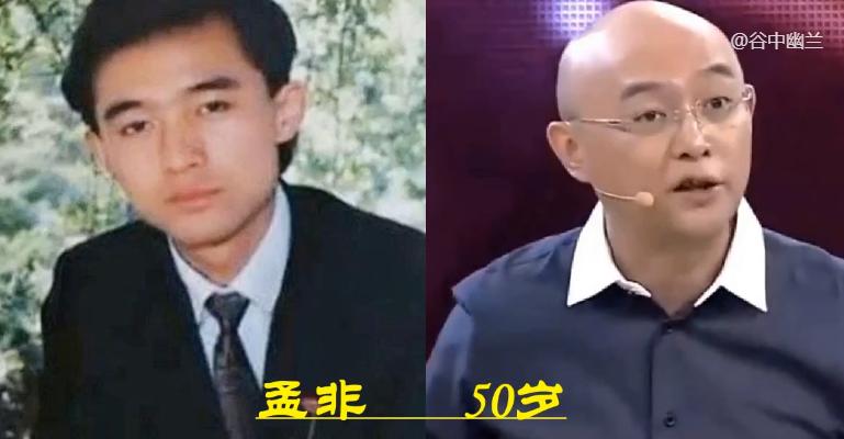 郭冬临头发变化史,郭冬临以前有头发现在光头