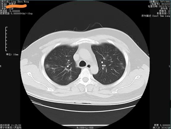 新冠复阳会感染吗,新冠复阳还是二次感染