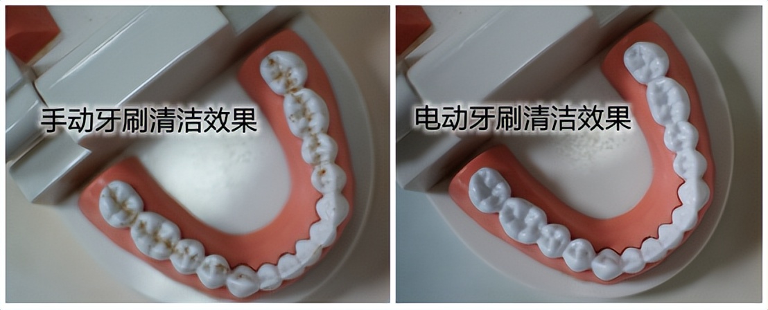 使用超声波电动牙刷有什么危害吗,老年人用电动牙刷的危害