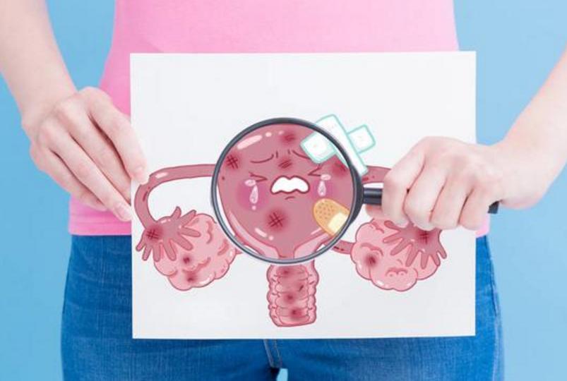 女子下身检查疼痛难忍,女性突然腹痛查出盆腔出血