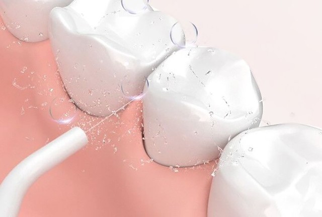 智商税和冲牙器有什么区别,冲牙器危害