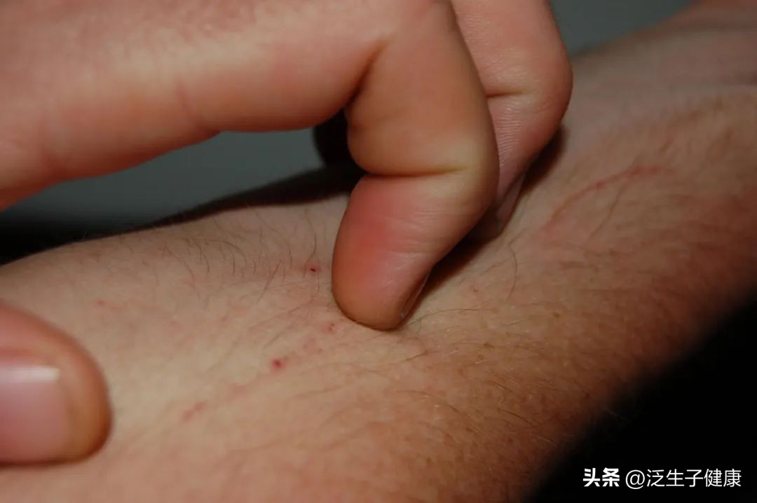 痒痒肉指的是哪里,痒痒肉是哪