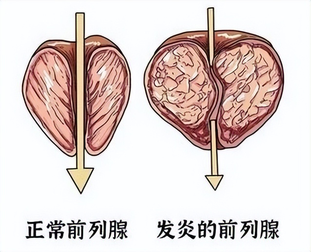 精神一紧张就想上厕所怎么回事,坐车紧张焦虑要上厕所怎么办
