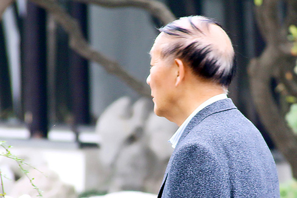 黑色染发剂最伤头发吗,黑色染发剂会不会不自然