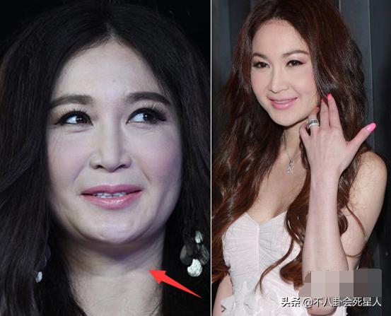 颈纹越来越多越来越显老怎么办,顽固又显老的颈纹