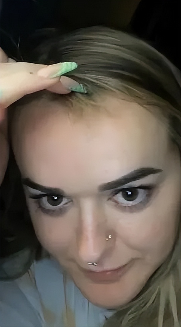 加拿大妈妈发现儿子头发莫名“越留越短”，居然是被家里豚鼠啃得