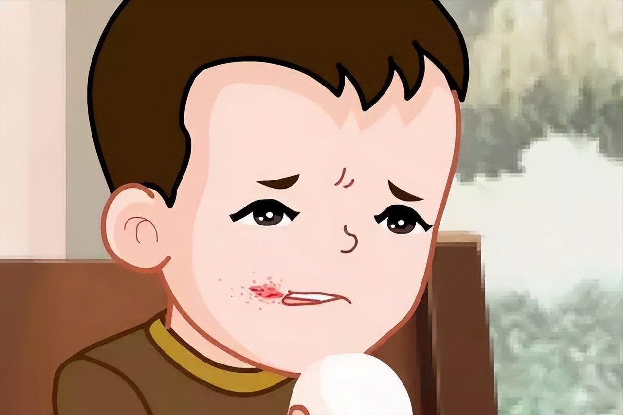 嘴角起泡烂嘴角是癌症吗,烂嘴角是癌症的表现吗