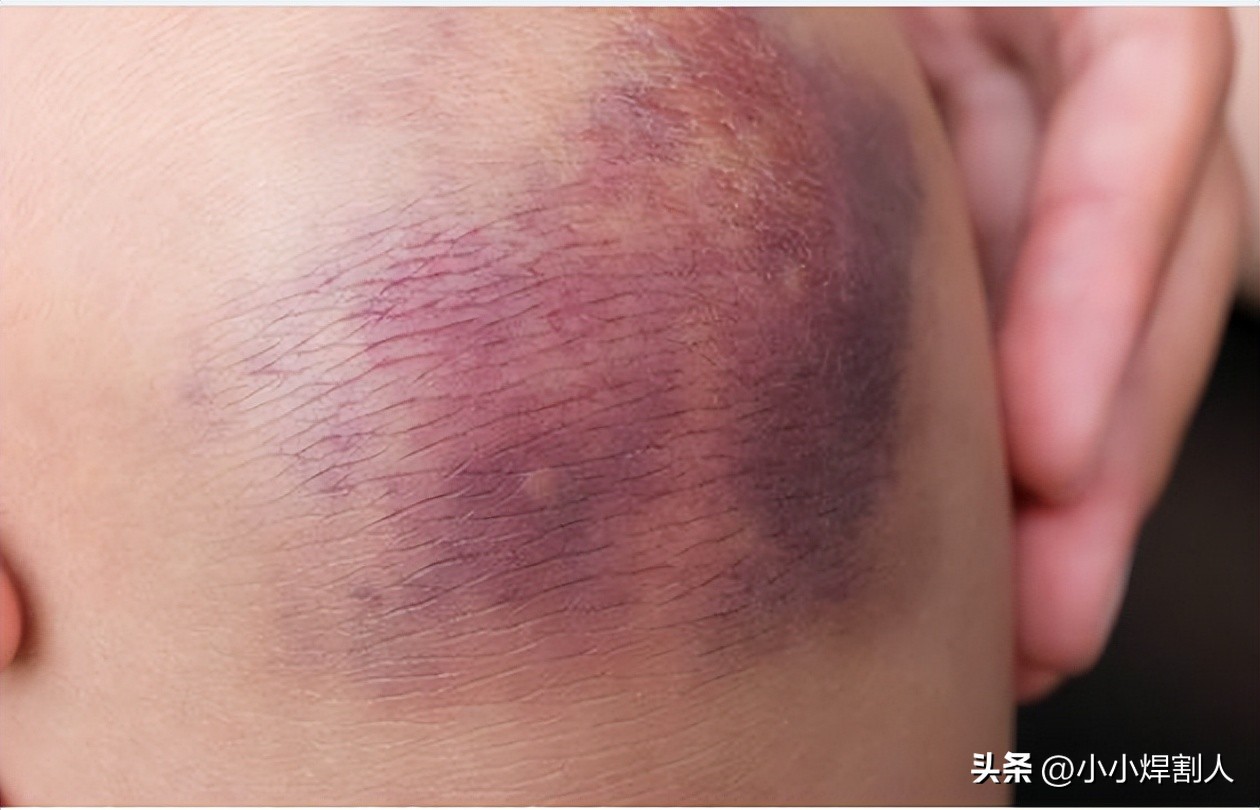 泥瓦工捡到“小铁块”,结果全家三人丧命,致141人受伤…