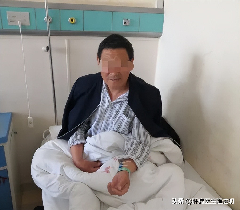 一位肝腹水患者的康复案例,我的肝硬化治疗经验分享