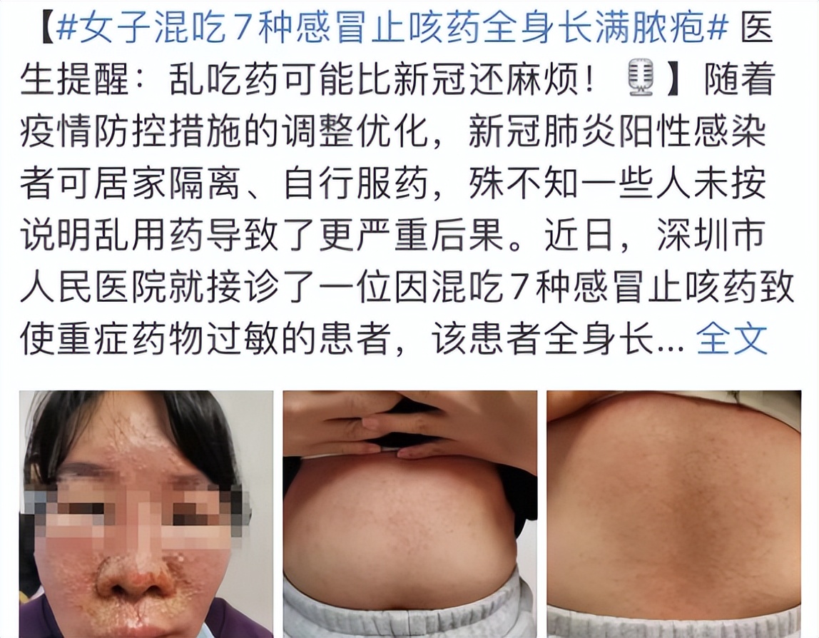 我阳了，但我抢不到布洛芬和黄桃罐头