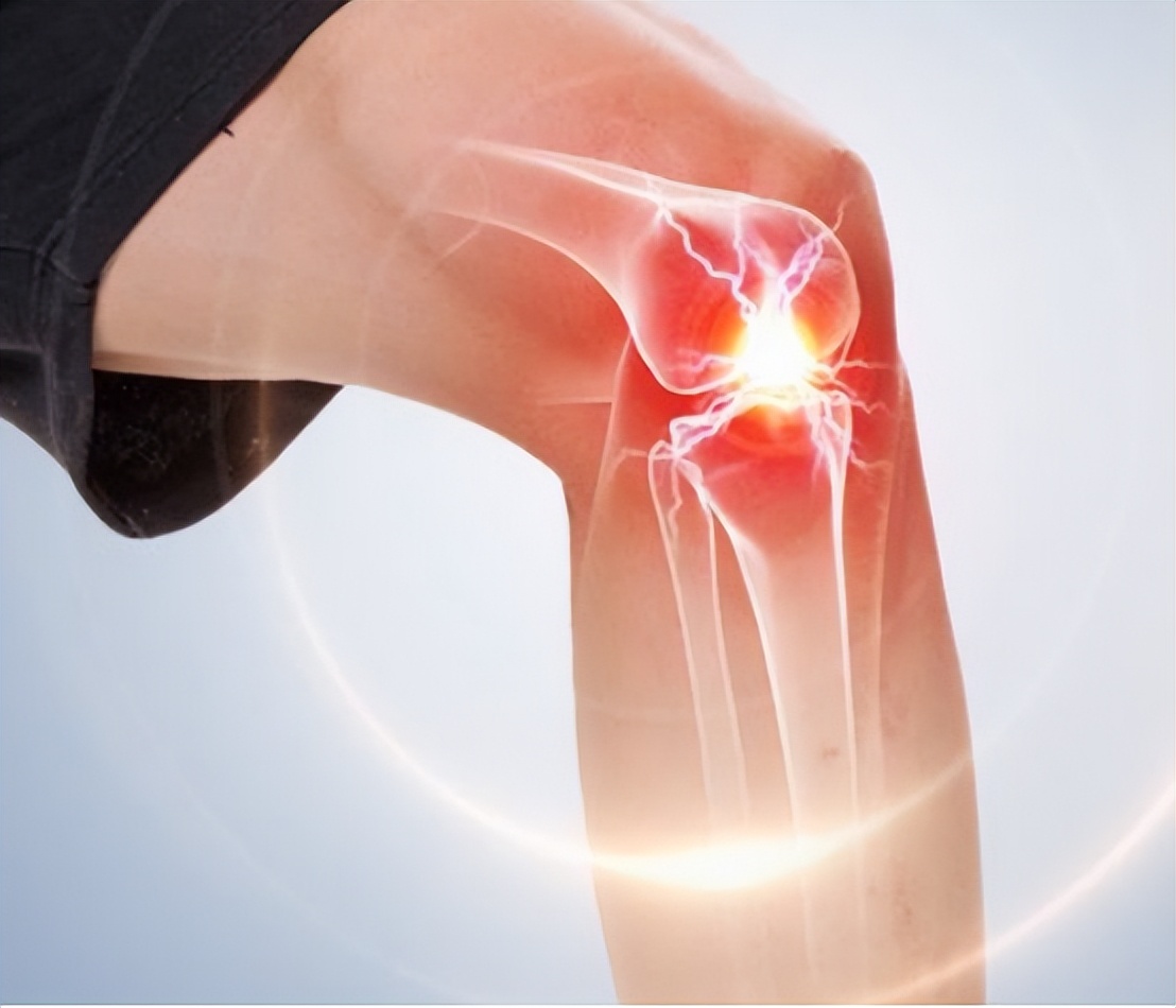 全球唯一可以治愈骨关节炎的药物,骨关节炎特效药最新研究