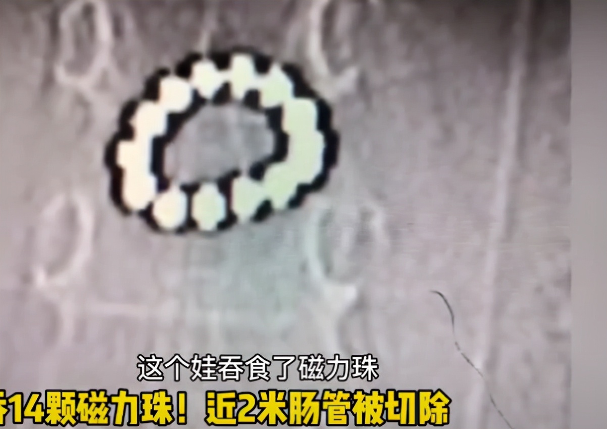 当父母千万注意！只因吃了30多颗，男孩成半植物人...家中这些千万要藏好！尤其第一个，很常见