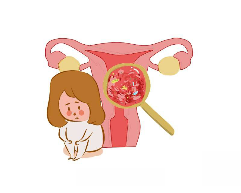 女人经常腹痛是不是妇科病引起的,妇科什么疾病会引起剧烈腹痛