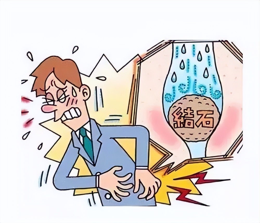有一种疼叫你不懂结石的疼,肾结石痛得大喊