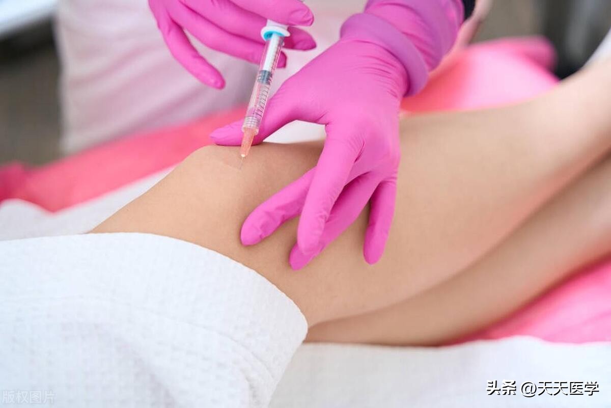 膝关节穿刺的适应症及穿刺方法,关节穿刺术适用部位