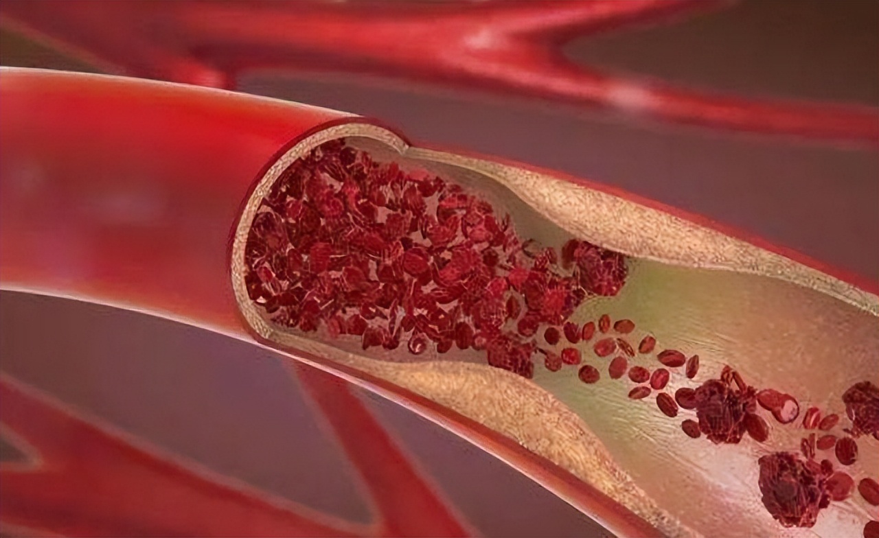 清理肠道对便秘有好处吗,便秘对人体的伤害