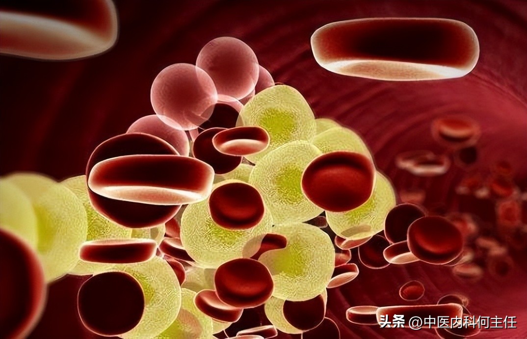 一种降血脂的中药组合物,降血脂的著名中药汤剂