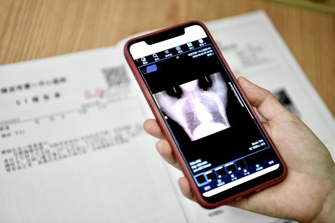 河北保定市第一中心医院,保定第一中心医院影像科