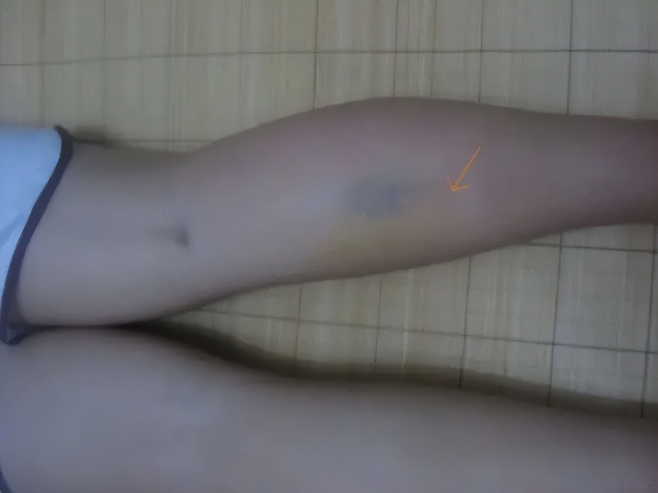 晚上睡觉嘴巴发干是什么原因呢,晚上睡觉嘴巴总是发干是什么原因