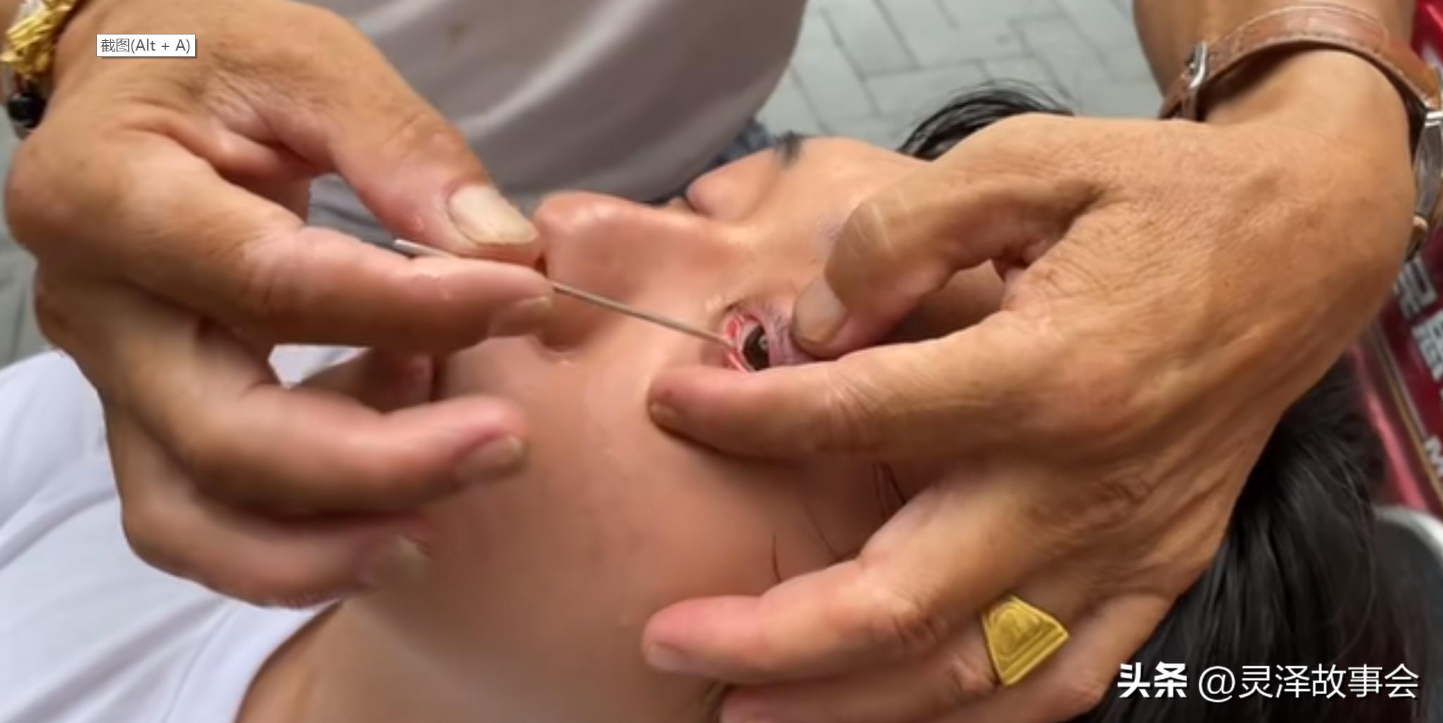 四川绝活刀锋洗眼有什么效果,正宗成都刀锋洗眼视频