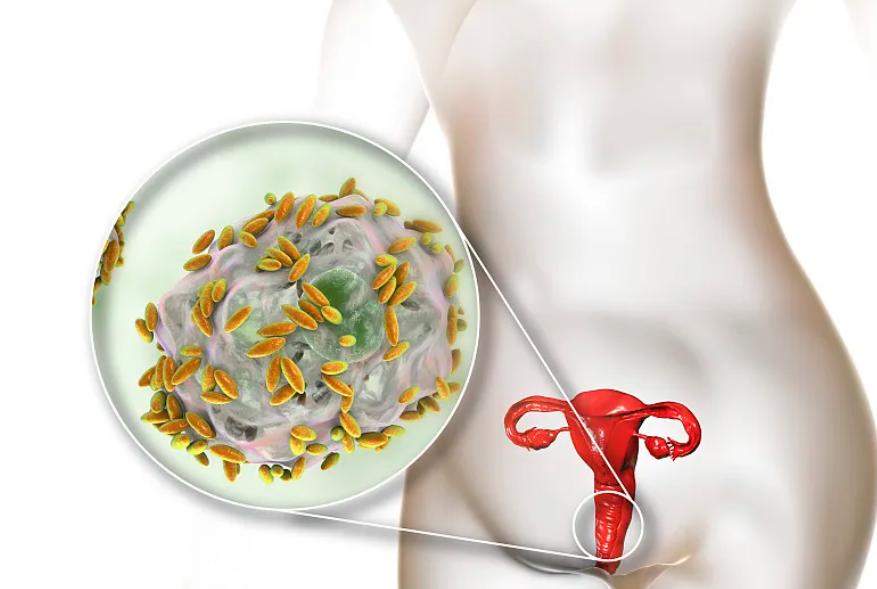 女人的“尴尬部位”老是瘙痒?医生：这4个原因，最好一个个弄清
