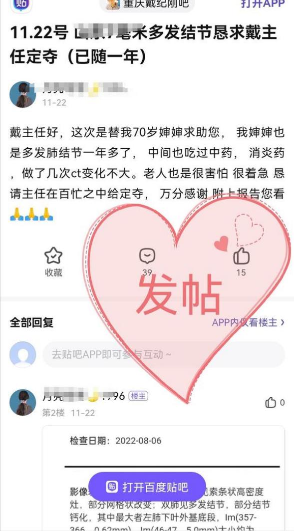 从肺结节到磨玻璃结节是怎么回事,0.6-0.65cm磨玻璃结节需要手术吗