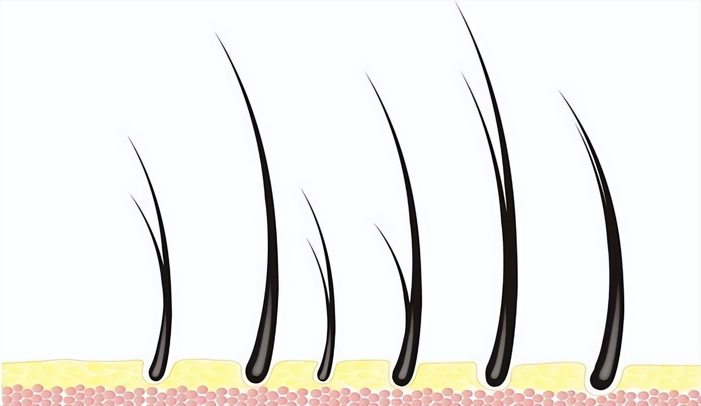 阴毛有什么用？要不要刮掉？由黑变白，说明了什么？男女都应了解