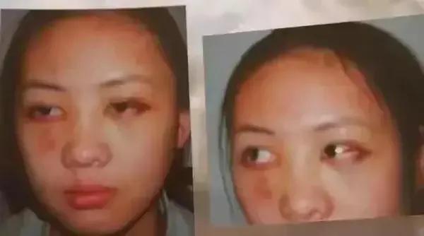 张默给童瑶道歉了么,2003年张默打童瑶事件