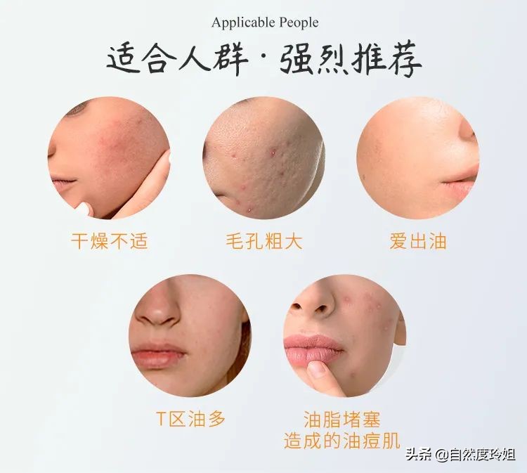 拥有了这瓶“肌肤凉茶”，出油、爆痘、毛孔粗大都会渐渐离你而去